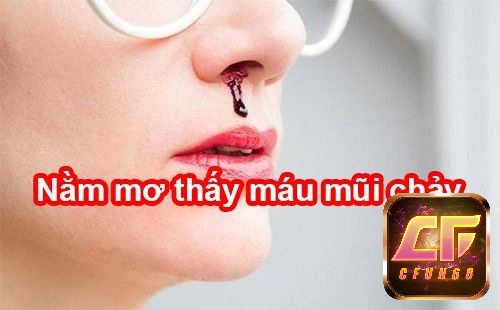 Năm mơ thấy máu mũi chảy tương lai có sự cải vã